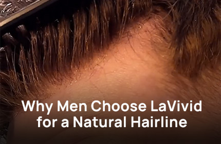 Why Men Choose LaVivid for a Natural Hairline